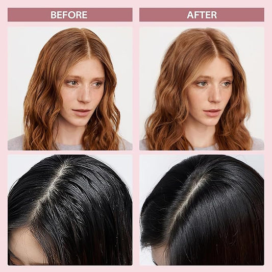 YLNALO Dry Shampoo Powder 2 Packs, Mattifying Root Fuller Looking Refreshing Hair,Non-aerosol, No White Cast, Travel Size Dry Shampoo Suitable for Women and Men,0.58Oz