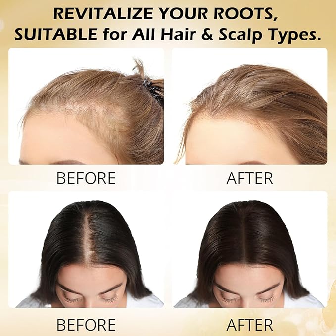 Root Activator Shampoo for Men-Hair Growth Shampoo for Hair Loss and Thinning Hair - Hair Loss for Women Men | Thickening & Nourishing For All Hair- 10.1 fl oz / 300 mL