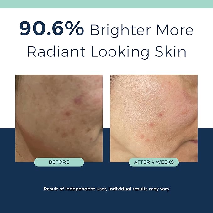 Anti-Aging Retinol Collagen Serum for Face- 1% Encapsulated Retinol, Niacinamide & Hyaluronic Acid Improves Wrinkles, Hydration, Skin Texture. Gentle for Sensitive Skin-Fragrance Free-1 FL OZ