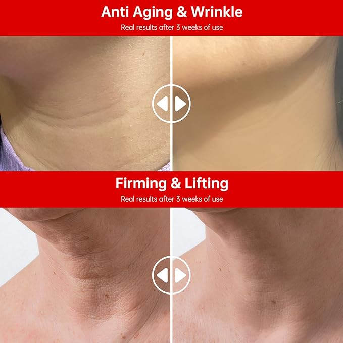 Neck Firming Cream with Retinol, Collagen & Hyaluronic Acid, Instant Lift & Tightening, Anti-Aging & Wrinkle Cream for Women & Man, Hydrating and Nourishing Tighten and Lift Neck Cream - 1.69Fl Oz