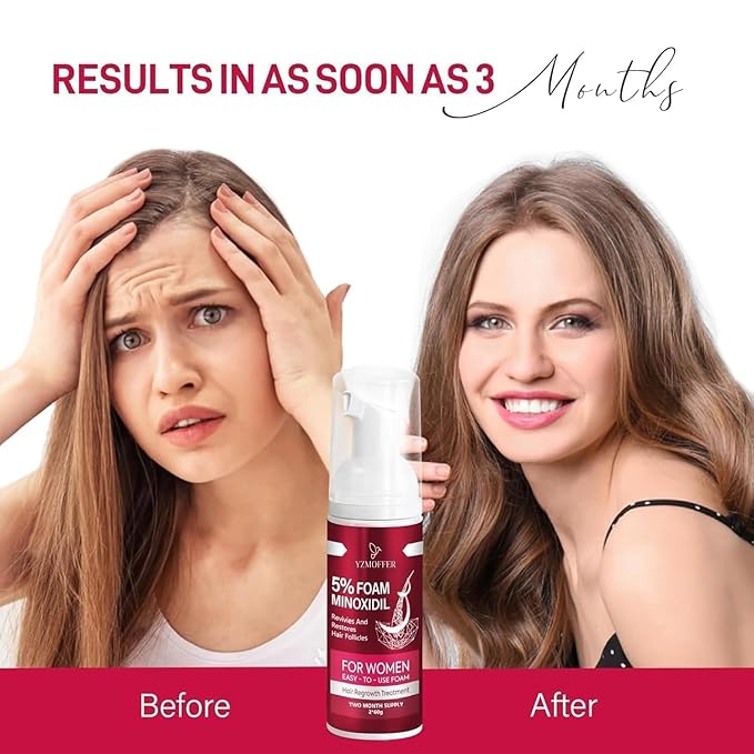 5% Minoxidil Foam for Women, Hair Regrowth Treatment for Thinning Hair and Hair Loss, Lightweight Non-Greasy Formula, Dermatologist Recommended, 2 × 60g (2-Month Supply)