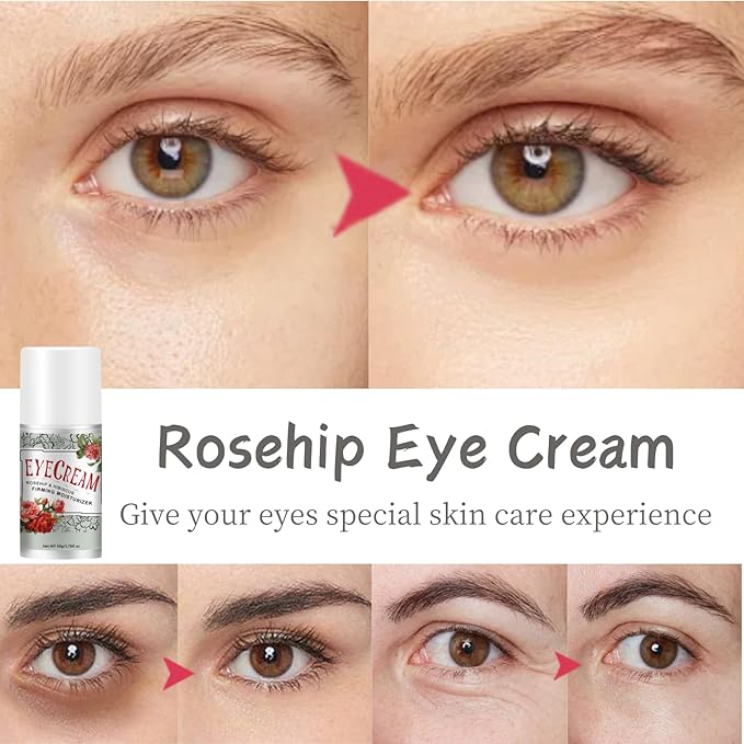 Rosehip Under Eye Cream for Dark Circles - Eye Cream Anti Aging - Anti Wrinkle eye cream for Puffiness and Bags Under Eyes - Firming Eye Serum for Women - Best Under Eye Treatment for Bags