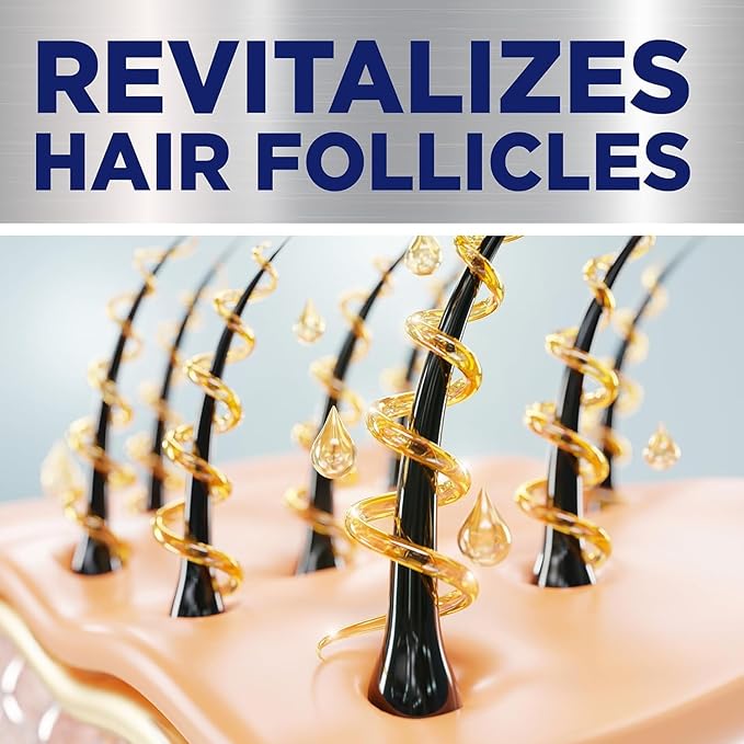 GoodSense Minoxidil Topical Solution USP, 5 Percent, Hair Regrowth Treatment for Men, Extra Strength 6 FL Oz (Pack of 4)