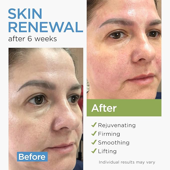 Collagen Face Cream with Stem Cells Retinol Hyaluronic Acid Niacinamide for All Skin Types - Anti-Aging Face Moisturizer with Airless Pump - Day & Night Cream for Wrinkles - Made in USA 1.7 Oz