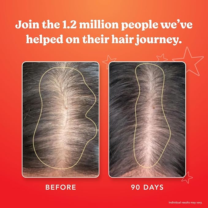 HAIRtamin Advanced Formula Hair Growth Supplement for Women & Men, Supports Stronger, Longer, Visibly Thicker Hair, With 5000 mcg Biotin, Vitamins & Antioxidants, 100% Vegan – 3 Month Supply