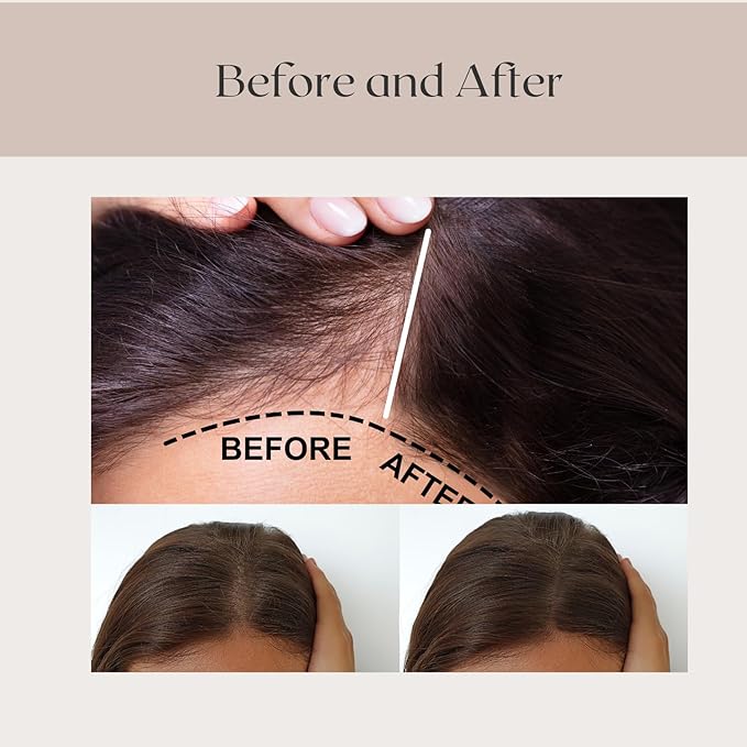 REVATOLOGY Hair Growth Serum and Leave-in Conditioner for Adults (Made in USA) Daily Use Formula 30 Oils and Herbal extracts Boosts Regrowth & Strengthens Roots | Cruelty & Chemical Free