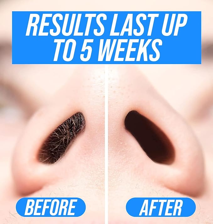 KENASHII Nose Wax Kit | 100 g Wax, 24 Applicators | Hair Removal Kit for Men and Women | Includes Balm Wipes and Mustache Guards | Lasts up to 5 Weeks