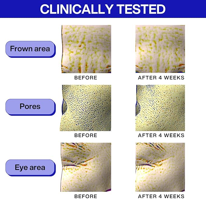 IOPE Retinol Super Bounce Serum | Korean Retinoid Eye Treatment for Anti-Aging, Beginner Friendly, Reduction in Fine Lines & Wrinkles, Firming and Rejuvenating, Daily Glow Routine, 1.01 Fl Oz.