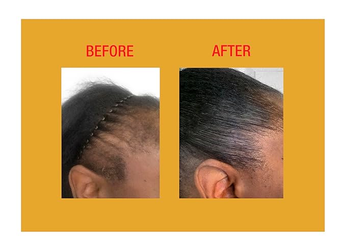 GOOD2GRO Hair Resuscitator with SureGro - 4oz | Repairs, Restores & Regrows Hair | Root-Activating with Tingling Sensation for Healthy Follicle Growth | Vegan & Cruelty-Free