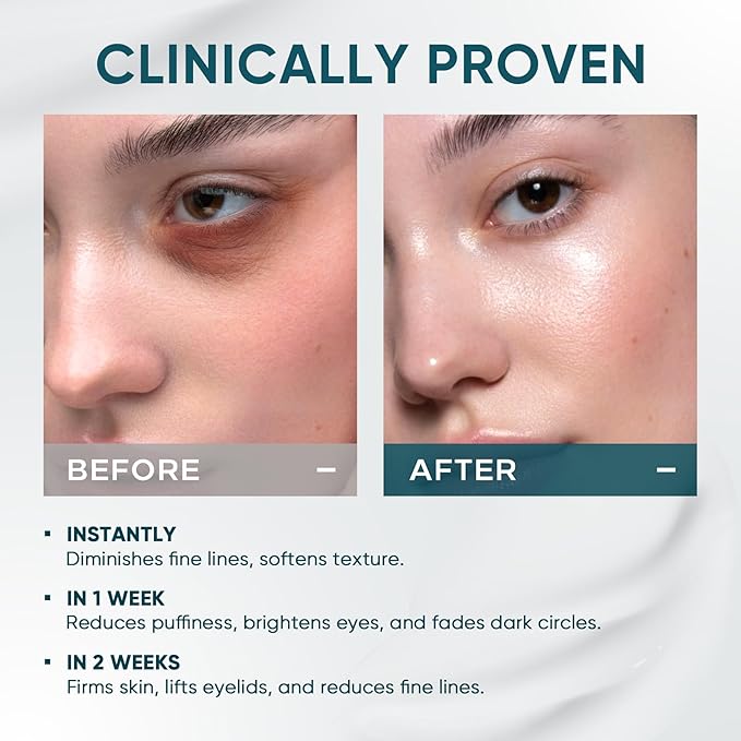 Elvira Dual Eye Cream for Dark Circles, Puffiness, Eye Bags, Wrinkles, Age-Defying, Tightening, and Moisturizing with Advanced Retinol, Five-Peptide Complex, and Stem Cell Extracts – 0.68 OZ