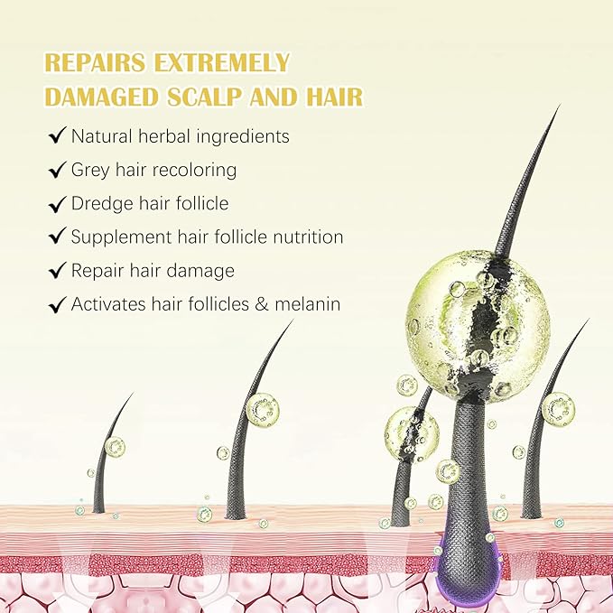 Uocasi 2Pack 5% Minoxidil Hair Growth Serum, Hair Growth for Men and Women, Hair Regrowth Serum For Stronger Thicker Longer Hair Help, Natural Facial Hair Treatment for Grooming Thickening