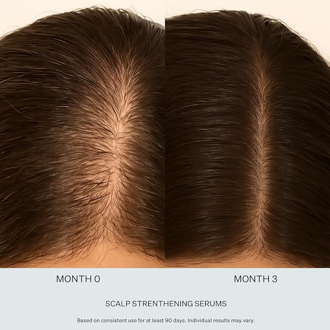 Stem Cell Serum for Men & Women - Helps Reduce Hair Loss - Strengthens & Thickens - Plant-Based - Combats Thinning Hair - Healthy Longer Hair - Root Nourishing Night (PM) - 28ml