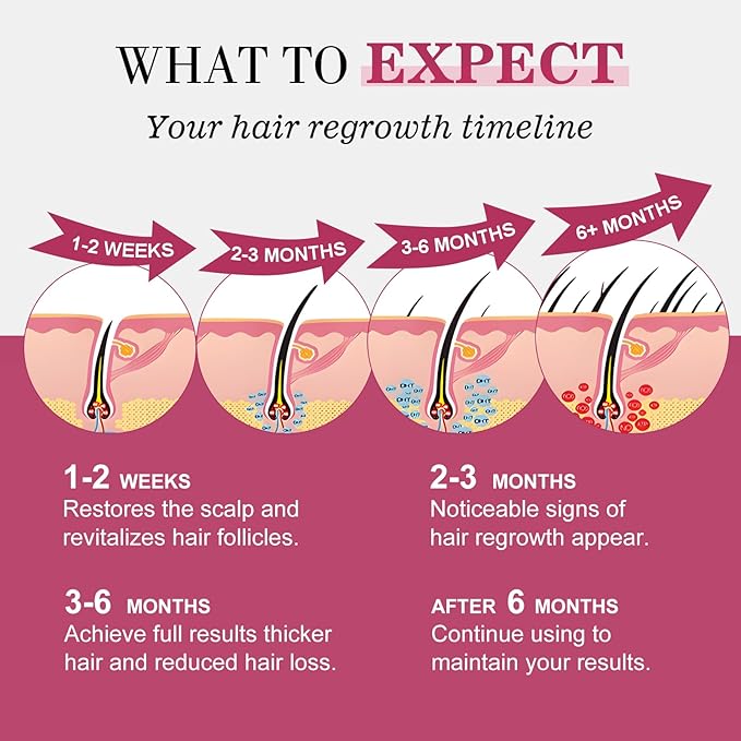 5% Minoxidil for Women Hair Regrowth Spray, hers hair regrowth treatment Infused with Biotin, Extra Strength Treatment to Combat Hair Loss and Thinning, 6 Bottles（100 Ml)