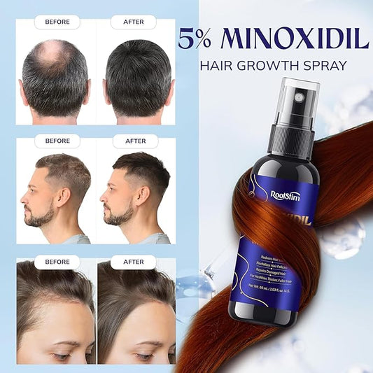 5% Minoxidil Hair Growth for Men and Women: 2-Pack Extra Strength Minoxidil Hair Loss Treatment Serum with Rosemary for Faster Stronger Thicker Hair Growth 4 FL OZ