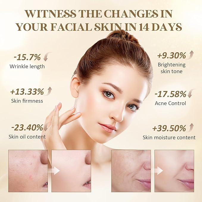 LED Face Mask Light Therapy, FSA Red Light Therapy for Face Wrinkle, Blue Light Therapy Mask for Face Acne, Rechargeable