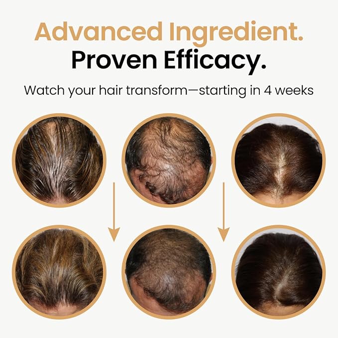 Hair Booster for Women & Men – Hair Revitalizing Serum with Capilia Longa & Arginine for Thick, Dry, Long, Damaged Hair – Peptide-Enriched Hair Tonic, 2 Fl Oz - Pack of 2