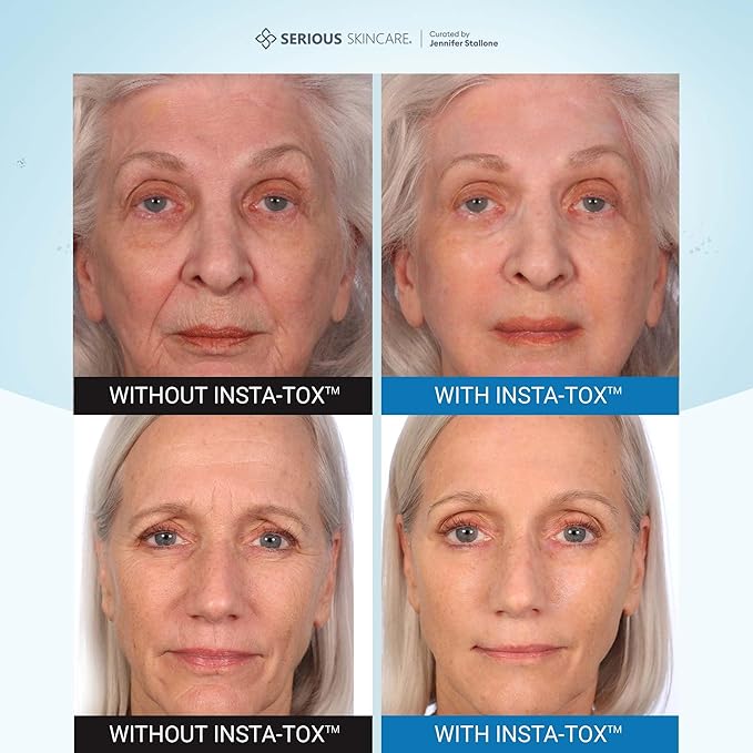 Serious Skincare - INSTA-TOX Instant Line and Wrinkle Filler Face Serum - Firm and Smooth Fine Lines, Deep Wrinkles and Pores - Temporary Skin Tightener - .75 oz