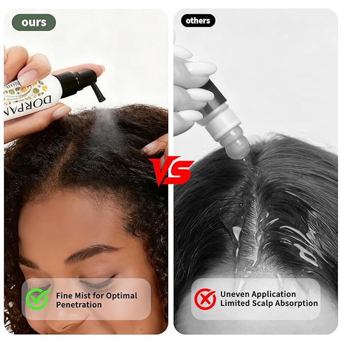 Hair Growth Serum, Women's Anti-Hair Loss Scalp Treatment, Helps with Severe Signs of Thinning, Non-Greasy, No-Rinse, Cruelty-Free, Vegan.