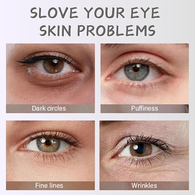 Rosehip Under Eye Cream for Dark Circles - Eye Cream Anti Aging - Anti Wrinkle eye cream for Puffiness and Bags Under Eyes - Firming Eye Serum for Women - Best Under Eye Treatment for Bags