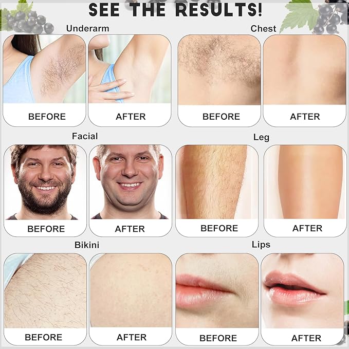 5 lb Hard Wax Bulk for Hair Removal, Gentle Rose Waxing Beads for Brazilian Bikini Waxing on Full-Body Sensitive Skin Face Leg Armpit Back Chest Coarse and Fine Hair Removal, with 10 Sticks, Black