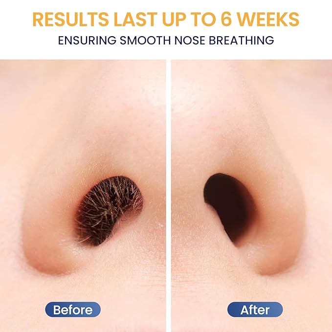 Nose Hair Wax Kit for Men, Nose Wax Removal with 100 g Wax, 40 Applicators, 15-20 Times, Ear Nasal Hair Waxing For Men and Women, Usb Rapid Heating, Constant Temperature, Painless, Black