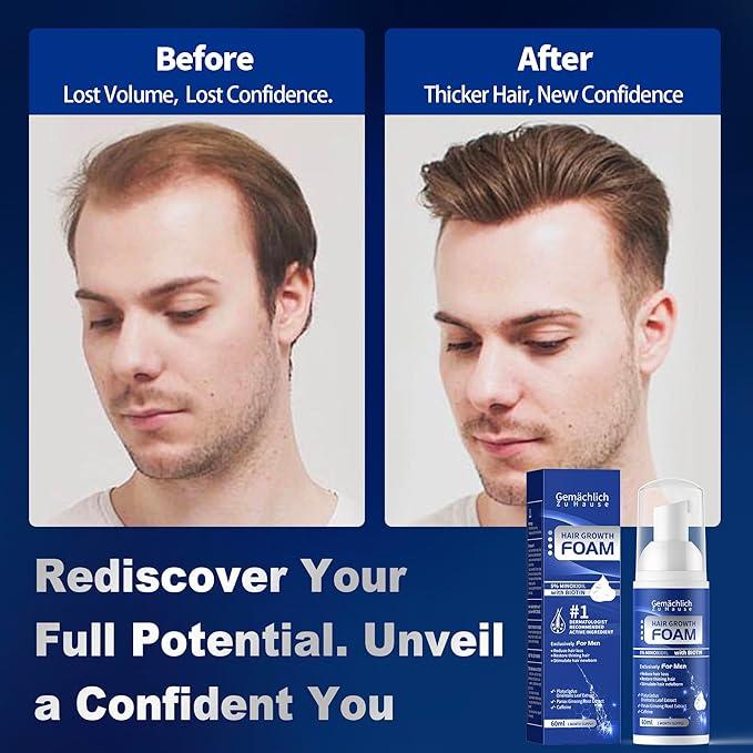 5% Minoxidil Foam for Men Hair Growth - Hair Regrowth Serum Treatment with Biotin, Caffeine, Rosemary Extract - Hair Loss Solution for Helps Prevent Thinning, Thickening Fuller Hair, Non-Greasy - 60ml