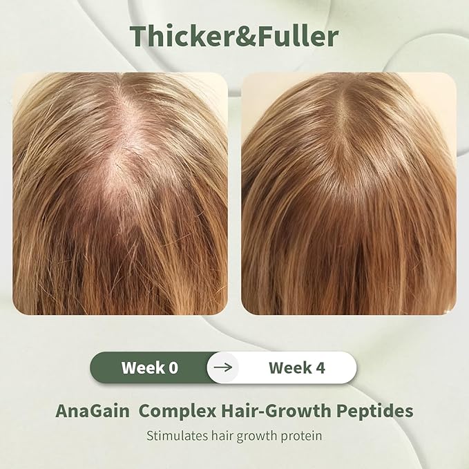 Hair Growth Serum, Women's Anti-Hair Loss Scalp Treatment, Helps with Severe Signs of Thinning, Non-Greasy, No-Rinse, Cruelty-Free, Vegan.