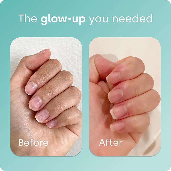 Biosil Collagen Booster Supplement - 120 Liquid Capsules - Patented ch-OSA Activator for Skin, Hair, Nails & Joints - Supports Natural Production - 60-Day Supply