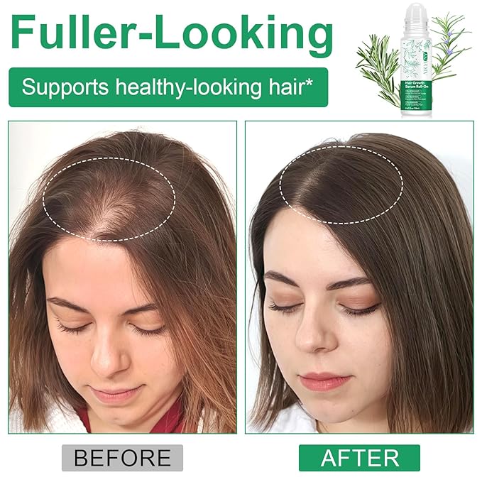 Hair Growth Serum Roll On – Rosemary Oil for Hair Growth with Redensyl & Anagain, DHT-Blocking Serum for Thicker, Stronger Hair & Reduced Hair Fall for Men & Women