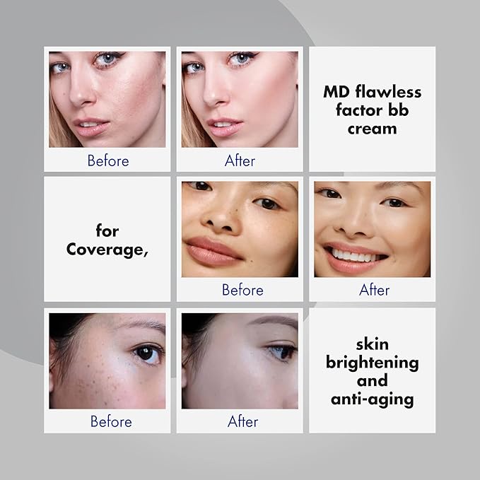 MD Flawless Factor BB Cream – Skin Brightening Anti-Aging Moisturizer with SPF 35 PA++ | 1.76 fl oz (50g) | Buildable Coverage
