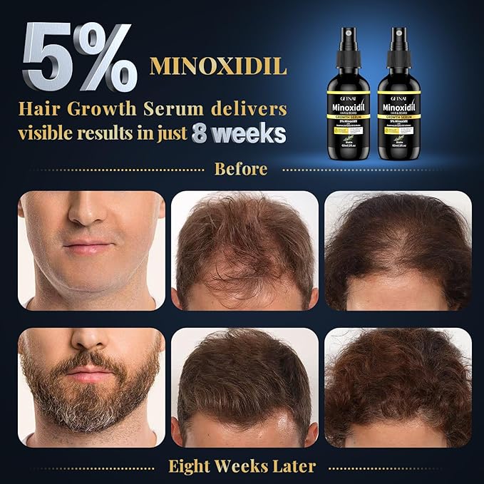 5% Minoxidil for Women with Biotin and Rosemary Hair Growth Serum (Glass Bottle), 5% Minoxidil for Men Spray for Thicker Fuller Hair