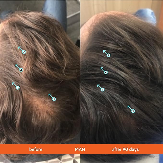 DS Labs Revita Shampoo & Conditioner Kit, 925 mL - Two-Step Scalp Care System for Fuller-Looking, Volumized Hair, Lightweight Hydration, Sulfate & Silicone Free, Color Safe, For Men & Women