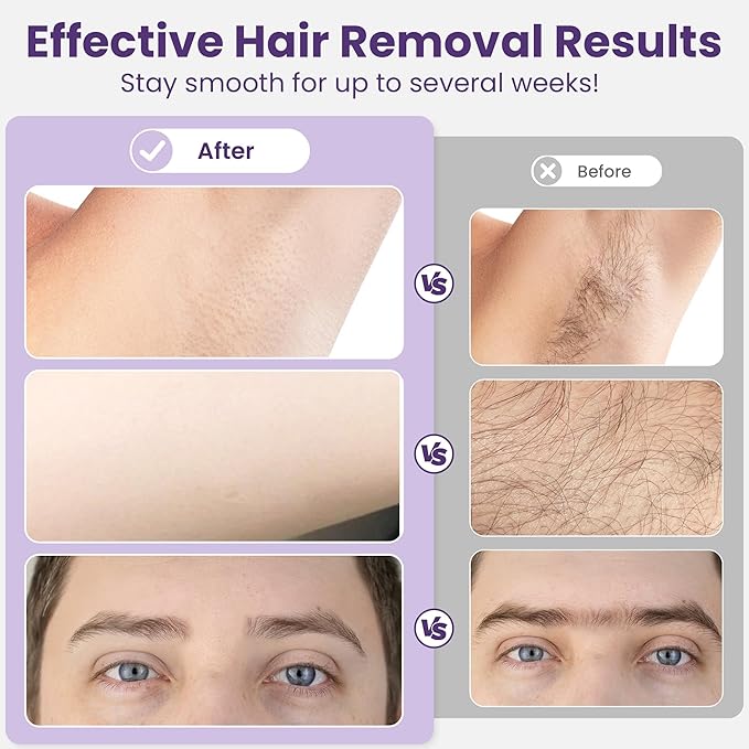 Sunvivi Waxing Kit, Brazilian Wax Warmer for Hair Removal with 5 Bag Hard Wax Beads, Digital Display Melt Warmer Kit for Women Men Full Body, Legs, Face, Bikini,Sensitive skin, White