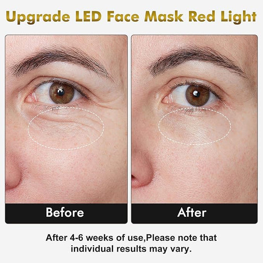 Red Light Therapy for Face & Neck Mask, Led Face Mask Light Therapy with 7 Colors, 309 LED Beads Silicone Facial Skin Care Device for Home SPA Beauty Salon