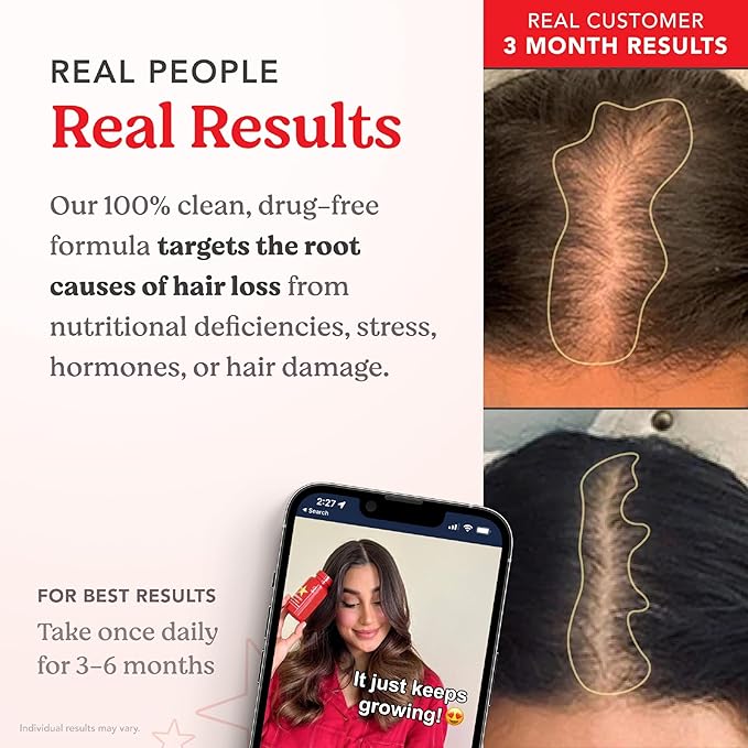 HAIRtamin Advanced Formula Hair Growth Supplement for Women & Men, Supports Stronger, Longer, Visibly Thicker Hair, With 5000 mcg Biotin, Vitamins & Antioxidants, 100% Vegan – 3 Month Supply