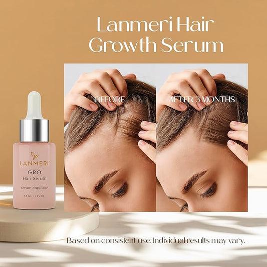 Lanmeri Vegan Hair Growth Serum - Natural Hair Regrowth and Hair Loss Treatments for Women & Men - Scalp Serum for Thinning Hair - Fuller, Thicker and Healthier Hair in 90 Days, All Hair Types