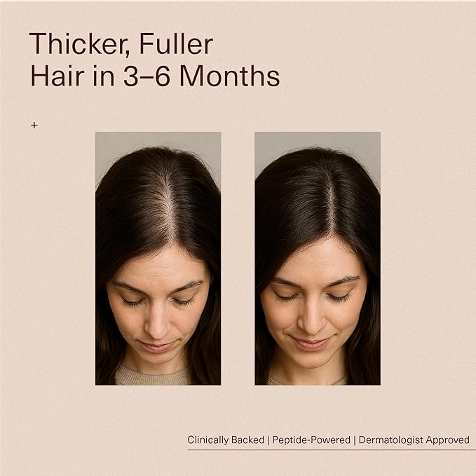 Bloom Clinically Proven Copper Peptide Hair Serum for Hair Growth - Non-Greasy & Lightweight Advanced Multi-Peptides for Women w/Thinning Hair - Promotes Fullness, Reduces Shedding - Made in USA