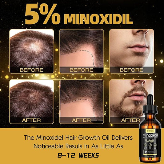 5% Minoxidil Hair Growth Oil for Men & Women - Extra Strength Regrowth Serum, Topical Hair Loss Treatment Serum, Thicker, Healthier Hair & Beard Growth, 2.11 oz