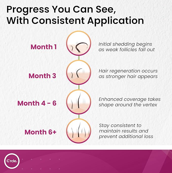 Minoxidil for Women 5% Foam - Helps Restore Top of Scalp Hair Loss and Support Hair Growth for Women, Regrowth with Unscented Topical Treatment for Thinning Hair (5% Foam 4-Month Supply)