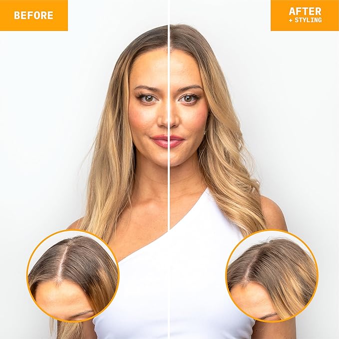 FoxyBae Dry Shampoo Spray for Women - All Hair Types - with Biotin, Vitamin E - Adds Texture, Volume; Absorbs Oil - Coco Beach - Sulfate & Paraben-Free - Beachy-Coconut Scented - Waterless - 7 Fl Oz