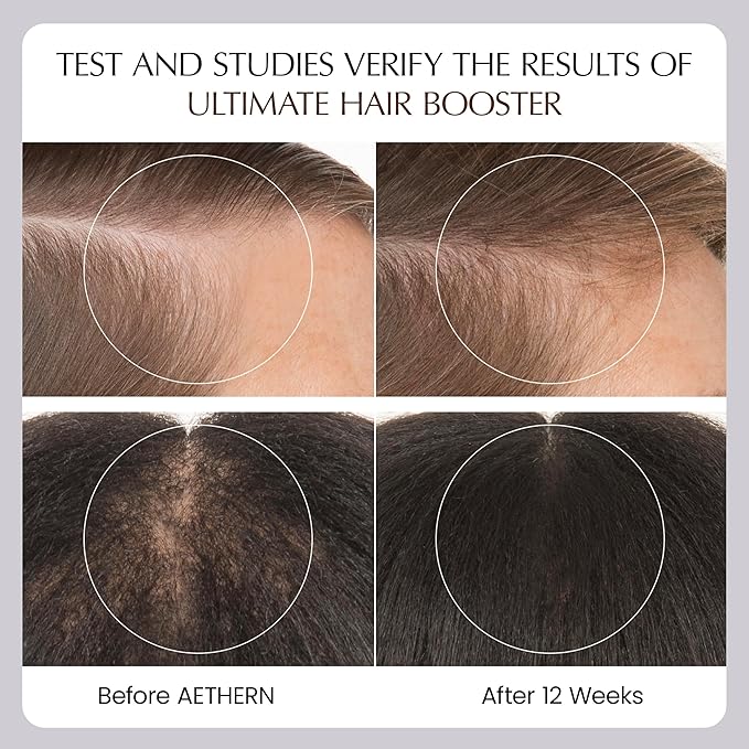 Liquid Hair Growth Supplement with Biotin. Ready-to-Drink. Clinically Proven for Stronger and Shinier Hair, Less Shedding, + Scalp Coverage. Anti-Hair Loss. 28 Servings Ultimate Hair Booster