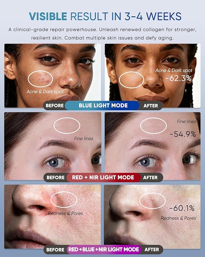 Red Light Therapy Mask for Face, LED Face Mask Light Therapy with Rechargeable Remote for Home & Travel, Blue & Near-Infrared Red Light (NIR) for Acne, Wrinkles, Gift for Women & Man