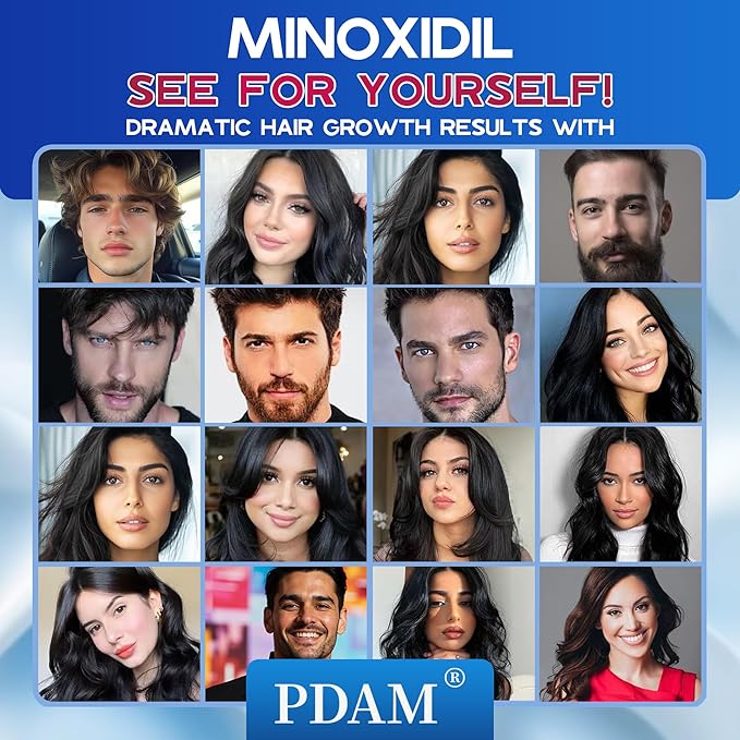 Minoxidil for Men and Women Foam Hair Growth - 5% Minoxidil Foam Hair Regrowth Treatment for Men, Topical Hair Loss Treatments, Extra Strength Thicker & Fuller Hair, 4 x 2.11 oz for 4 Months