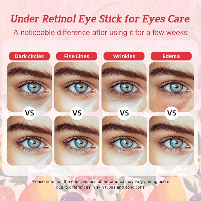 Multi Balm Stick: All-in-One Lip/Eye/Neck/Makeup Base. Advanced Eye Cream for Wrinkles, Dark Circles & Puffiness. With Retinol to Moisturize, Soften & Nourish