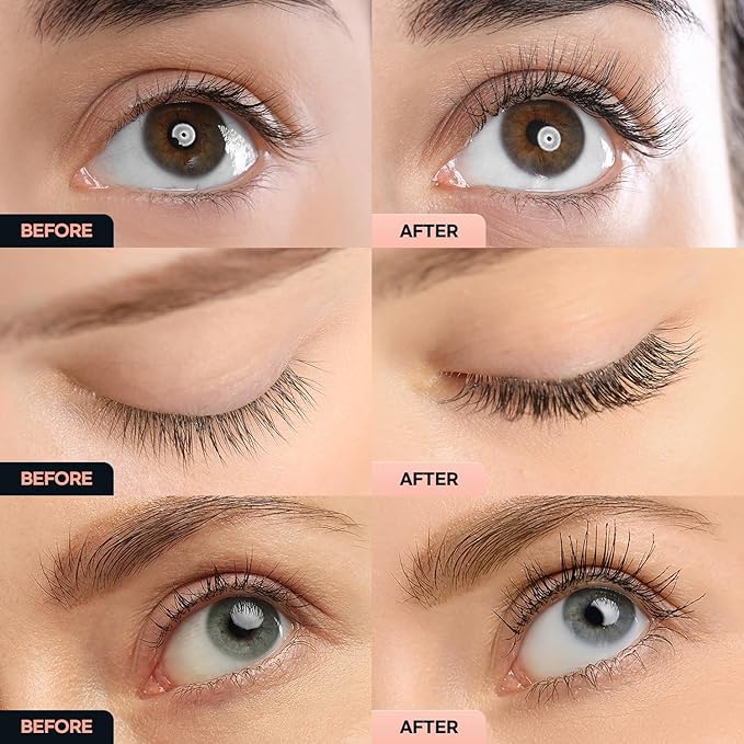 Essynaturals Eyelash Growth Serum, Premium Eyelash Serum, Lash Serum For Eyelash Growth, Eyelash Serum To Grow Lash, Irritation Free Lash Growth Serum