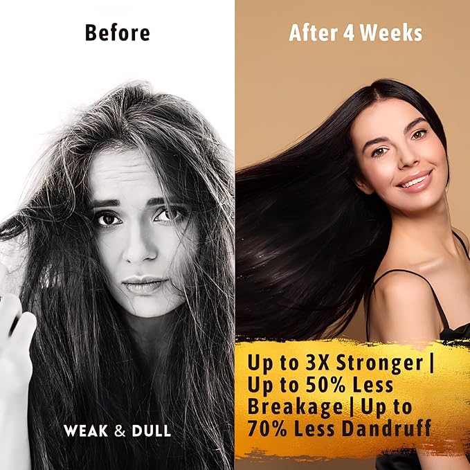 Hair Growth Serum Women & Men — 10-in-1 Tricho10™ Scalp Serum for Thicker, Fuller Hair & a Healthier Scalp — Fast-Absorbing, 3X Strengthening Blend for Thinning Hair & All Hair Types (1 fl oz / 30 ml)