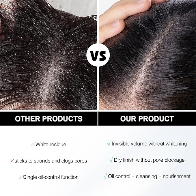 7.61Oz Hair Dry Shampoo Spray, Instantly Refreshes Hair No White Residue, Refresh Hair with Rice Starch - Absorbs Excess Oil, Oil Control and Volumizing Dry Shampoo for Women