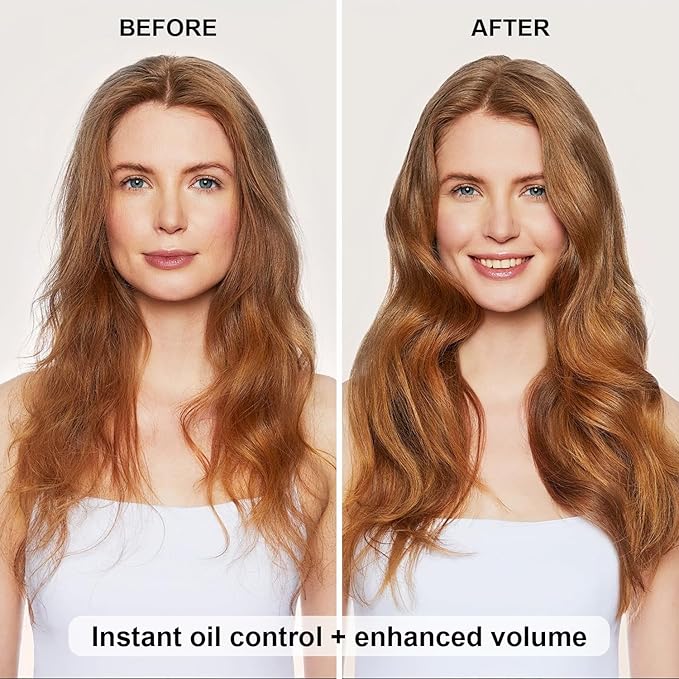 7.61Oz Hair Dry Shampoo Spray, Instantly Refreshes Hair No White Residue, Refresh Hair with Rice Starch - Absorbs Excess Oil, Oil Control and Volumizing Dry Shampoo for Women