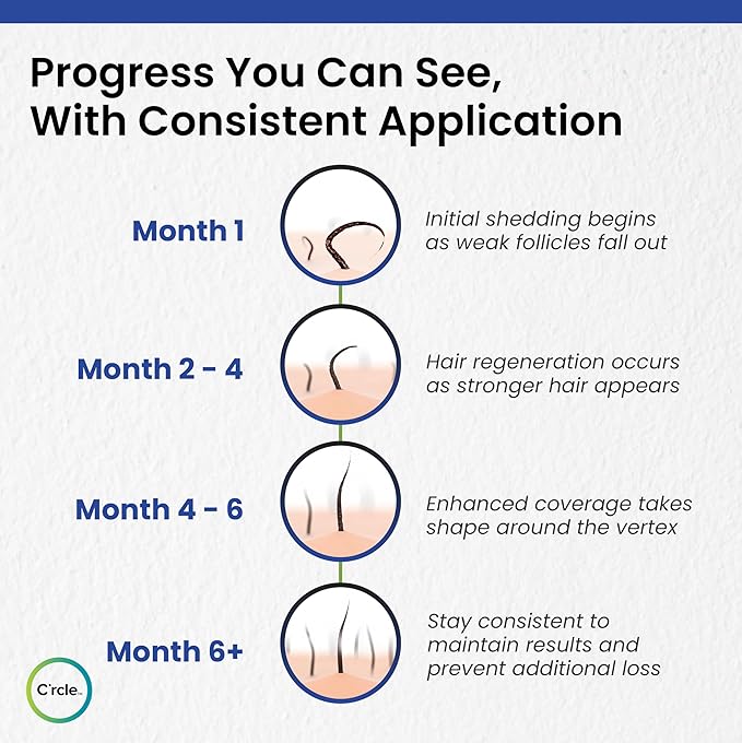 Minoxidil for Men Foam 5% - Unscented 3 Month Supply - Helps Restore Vertex Hair Loss & Thinning - 5% Minoxidil Foam For Men - Extra Strength Supports Hair Regrowth