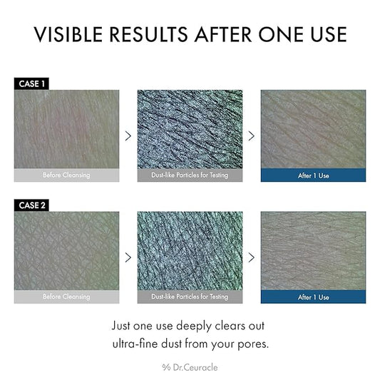 Dr.Ceuracle Pro Balance Enzyme Powder Face Wash - Korean Day and Night Natural Enzyme Powder Face Wash for Deep Pore Cleansing, Sebum Removing, pH Skin Balancing Care (Night Wash)